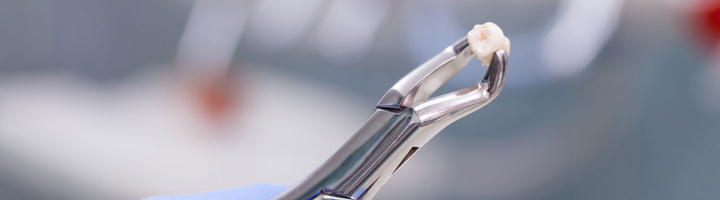 Extractions in Ermington, Sydney