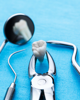 Extractions